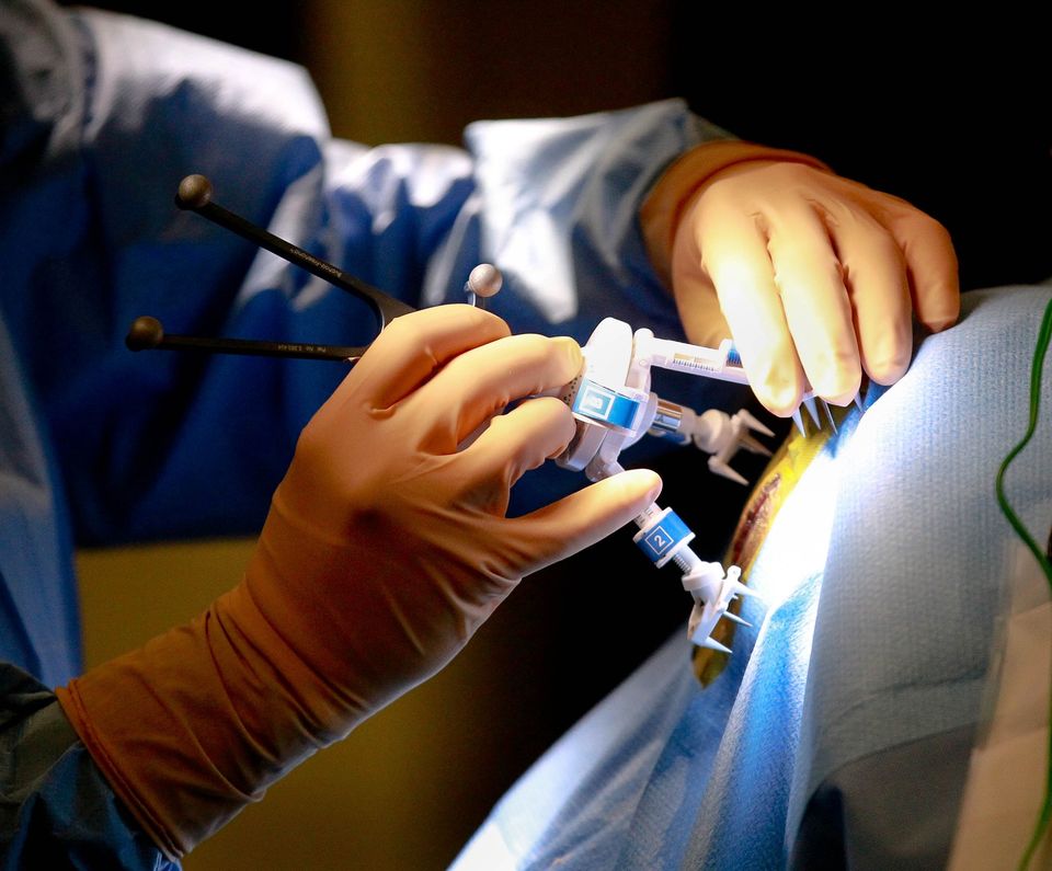 Laser surgery